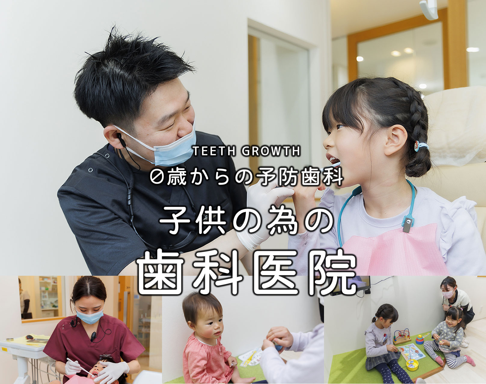 子供のうちからはじめる小児矯正